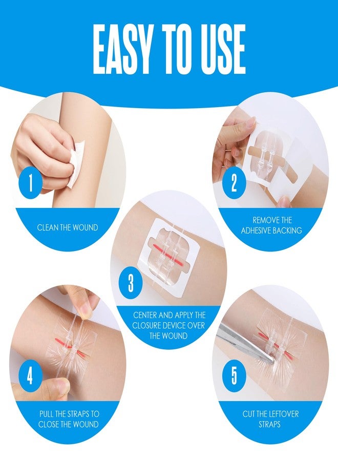 Houseables Zip Stitch, Wound Closure Strips, Butterfly Bandages, Laceration Closure Strips, Butterfly Stitches for Wounds, Emergency Laceration Kit, Zip Sutures, Emergency Skin Zipper Bandage, 4 Pack - Image 4